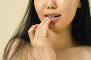 Nieprzyjemny zapach z ust - halitoza